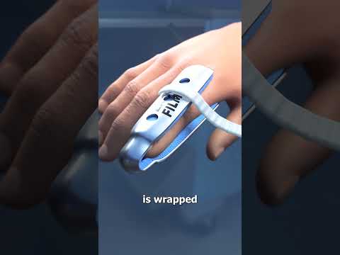 How Finger Splints Work 🤨