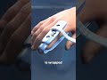 How Finger Splints Work 🤨