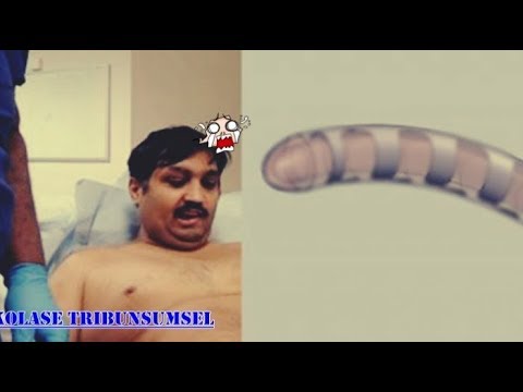 Buah kering untuk potensi Meningkatkan ukuran penis rumah