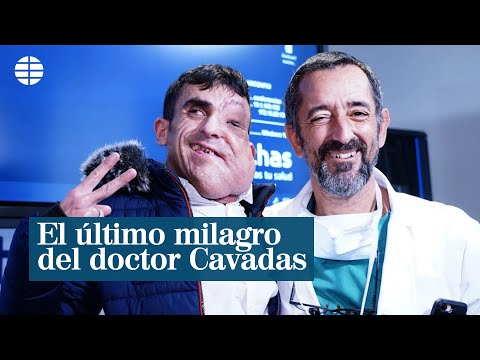 El doctor Cavadas extirpa a un joven un tumor gigante de la cara