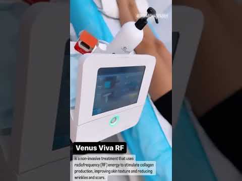 Venus Viva RF: Non-Invasive Treatment for Wrinkles, Scars, and Skin Texture Improvement