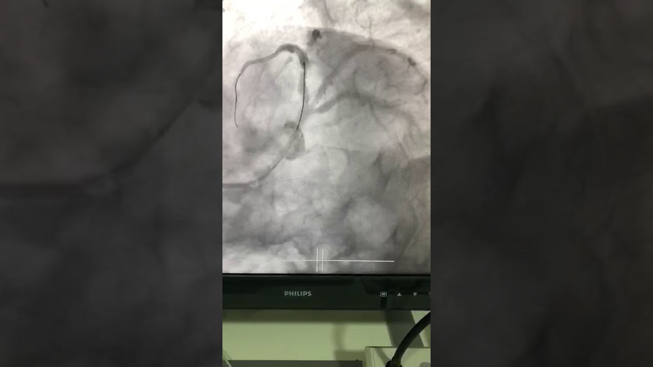 Karim Yarek Juarez Escobar-13