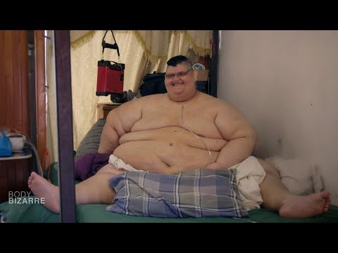 L'homme le plus gros du monde perd 225 kilos ! Body Bizarre
