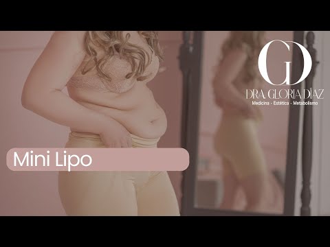 Introducción a la minilipo