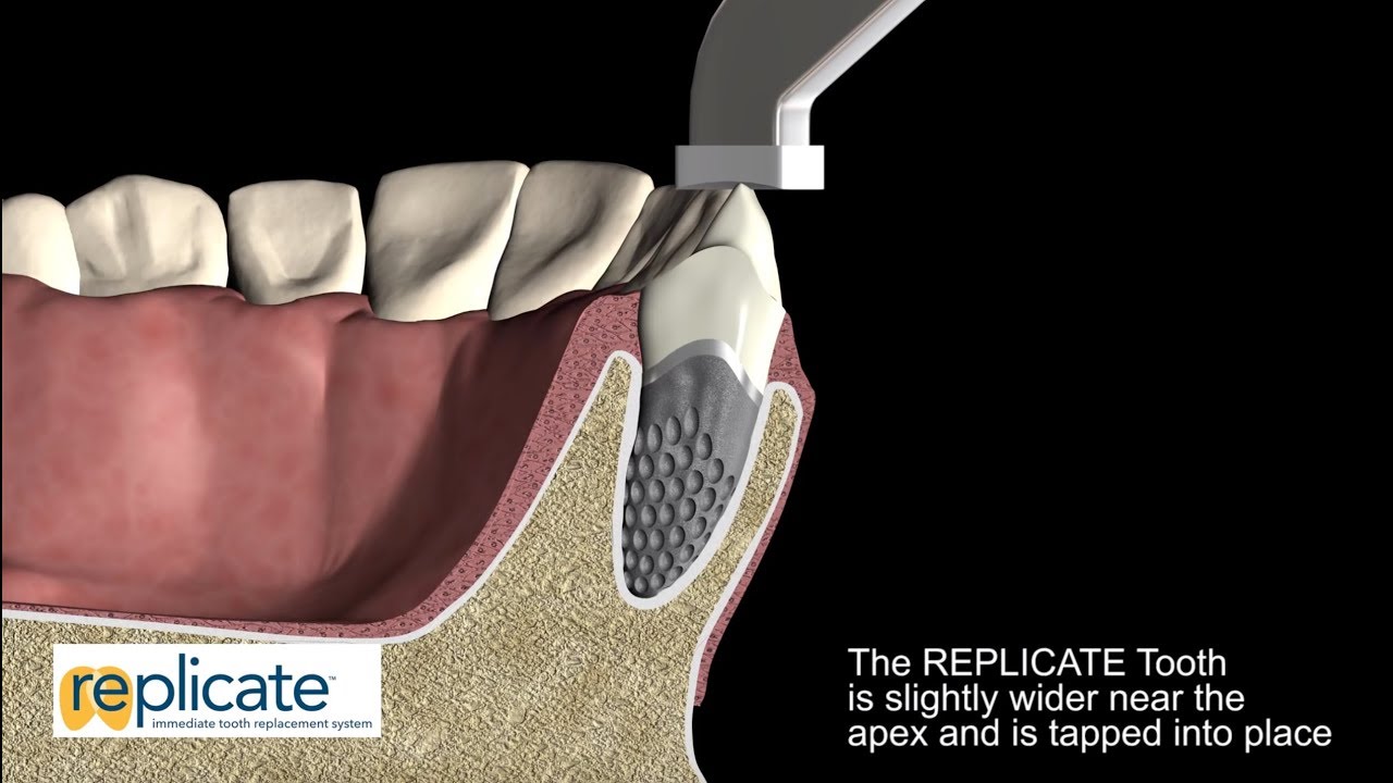 How it works - The REPLICATE® System