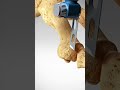 See How A Bunion Is Treated Bunionectomy With Osteotomy Toes Foot Feet
