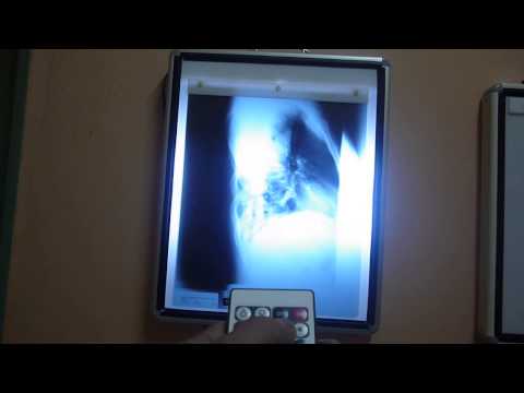 X-Ray viewer with remote control