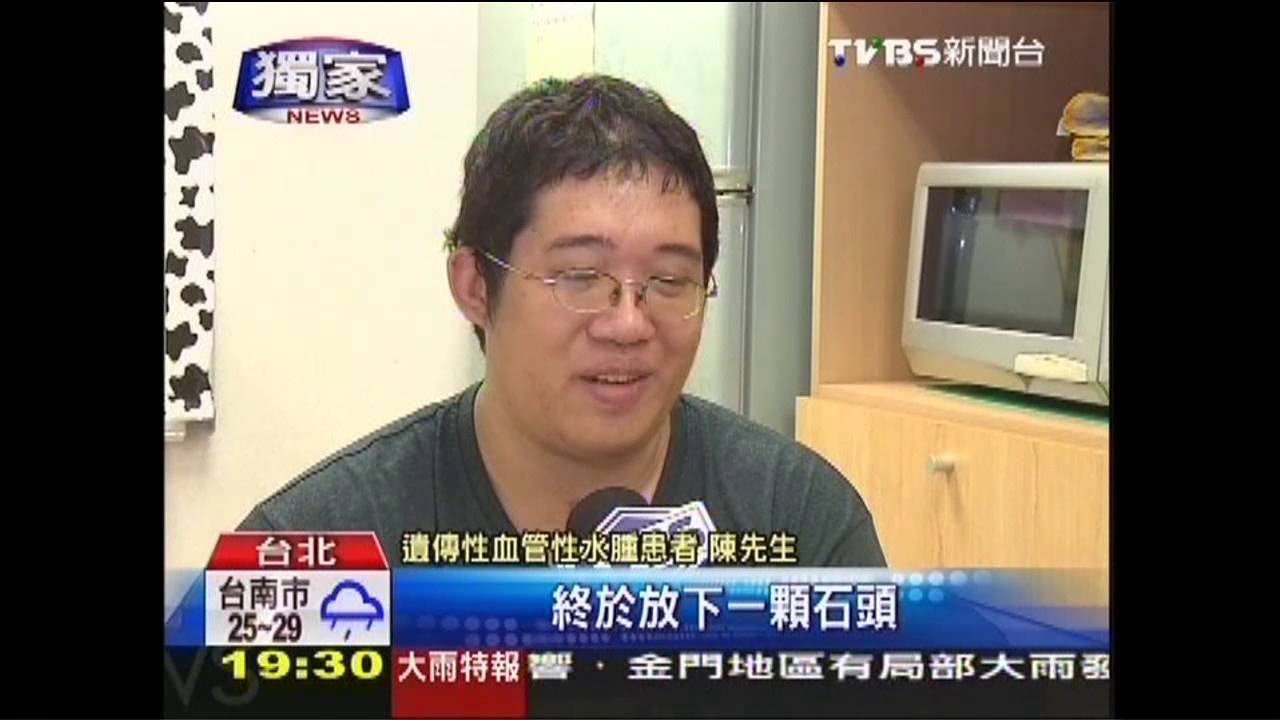 〈獨家〉「臉腫奪3命」罕病被當「過敏」　恐致死
