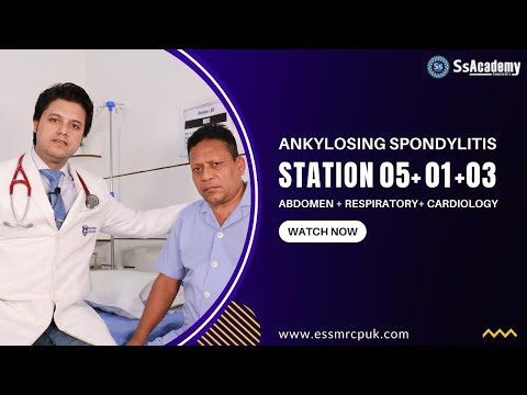 PACES 2023 New Format | Pulmonary Fibrosis- AS-Pulmonary Fibrosis due to Ankylosing Spondylitis