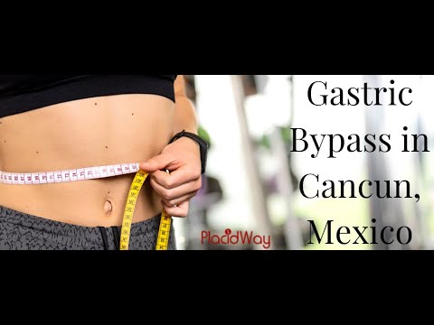 Gastric Bypass in Cancun, Mexico