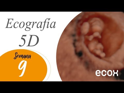 Vídeo de ecografía 5D de 9 Semanas de embarazo