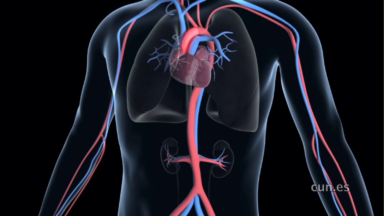 Aneurisma de aorta