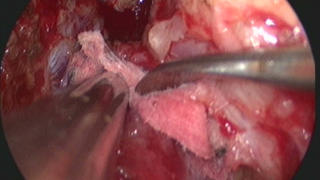 Arthur Maynart Pereira Oliveira-4