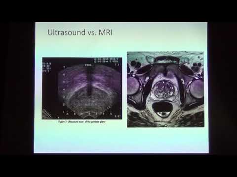 19-05. Bernadette Greenwood BSc, RT "Prostate Cancer Diagnosis & Treatment- A MRI-based approach"