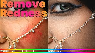 How to Remove Skin Redness - Photoshop Tutorial