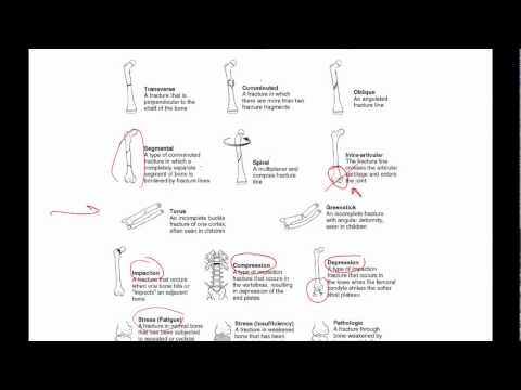 General principles of ortho trauma for PA students 1 - basics