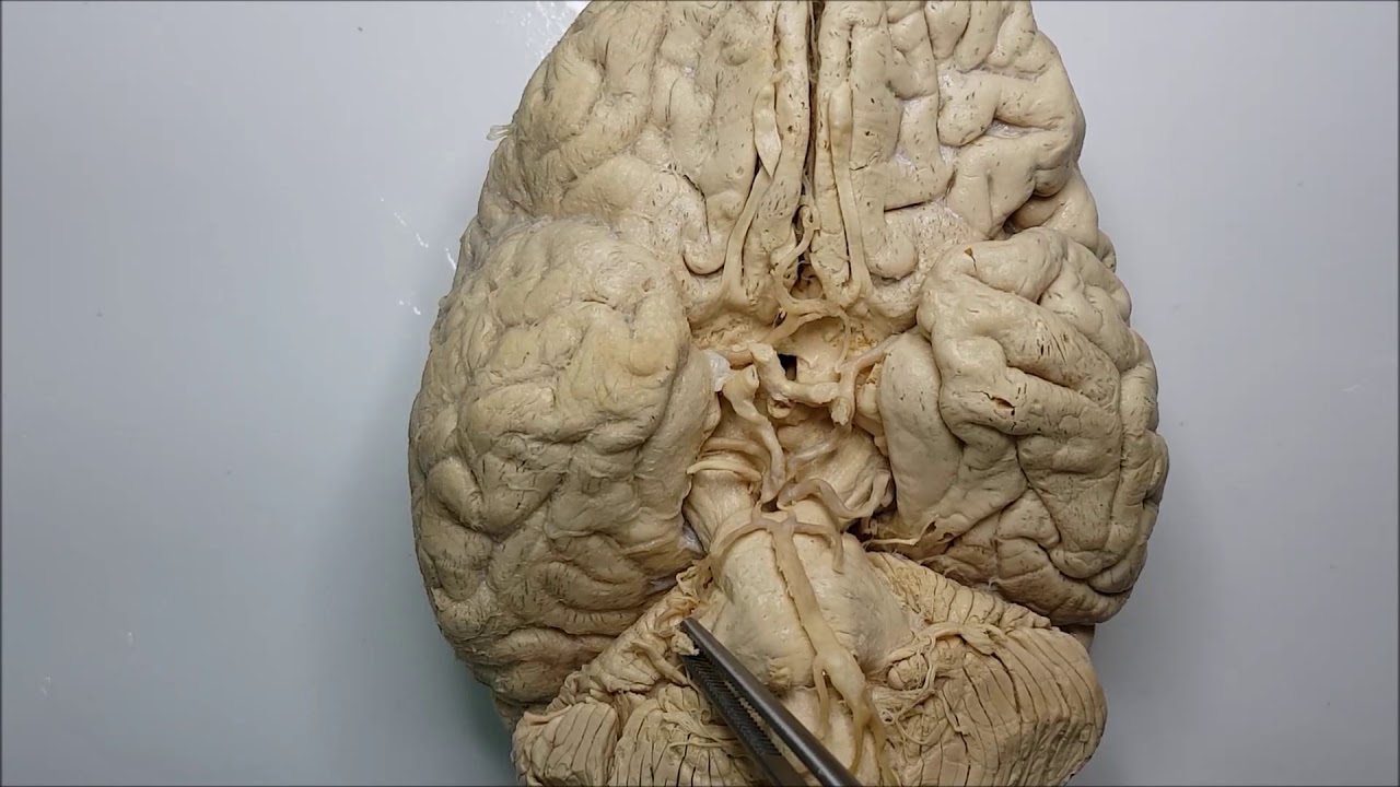 Anatomia dos Nervos cranianos