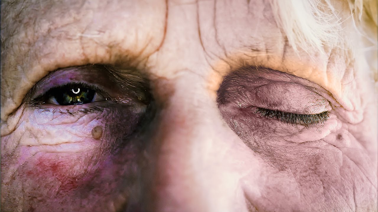 The coma and its mysteries