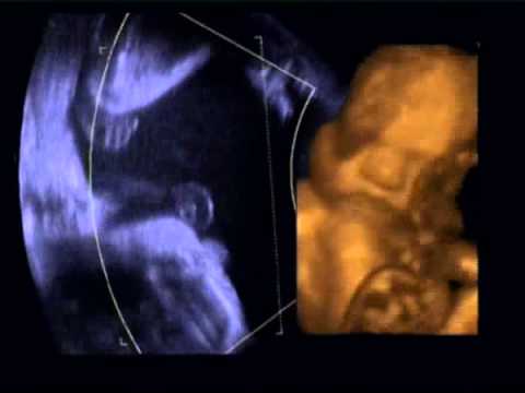 Ultrasound images of baby at 29 weeks