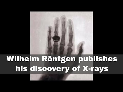 image-When were X rays first used? 