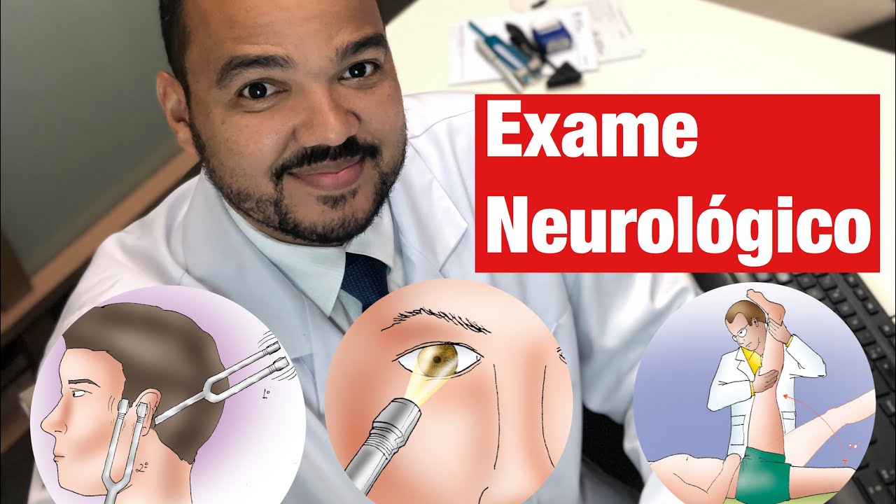 Exame Neurológico: o que é, para que serve