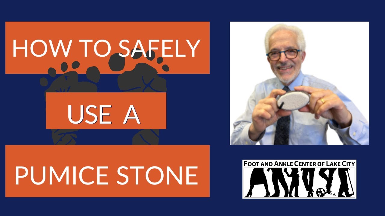 How to Remove Dead Skin and Calluses Safely With A Pumice Stone