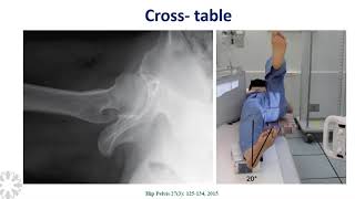 Anatomia radiológica de la cadera