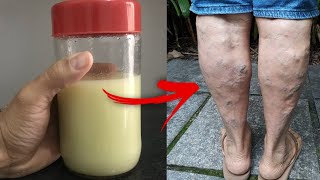 COMO MELHORAR A CIRCULAO E ACABAR COM INCHAO NAS PERNAS