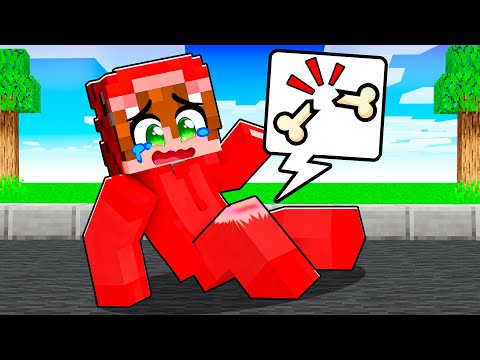 Dagar Se Rompe La Pierna en Minecraft!