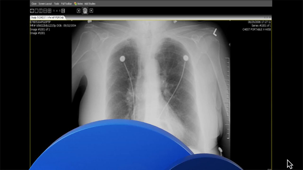 MEDHOST EHR Demo Video