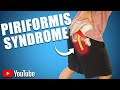 Persistent Buttock Pain BEST STRETCHES EXERCISES ADVICE For PIRIFORMIS SYNDROME