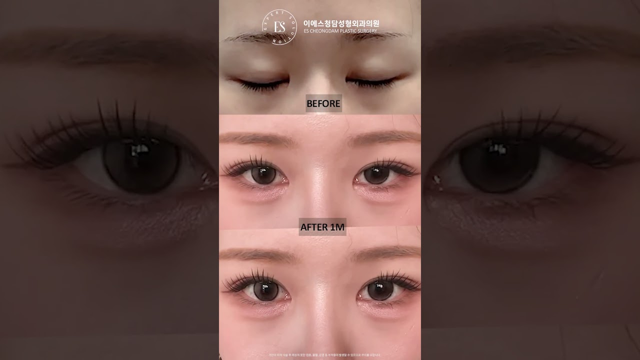 이에스 유튜브