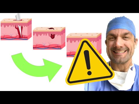 Why isn’t the Wound Healing?  It’s NOT the wound!