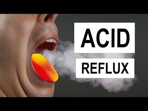 How Acid Reflux DESTROYS Your Throat