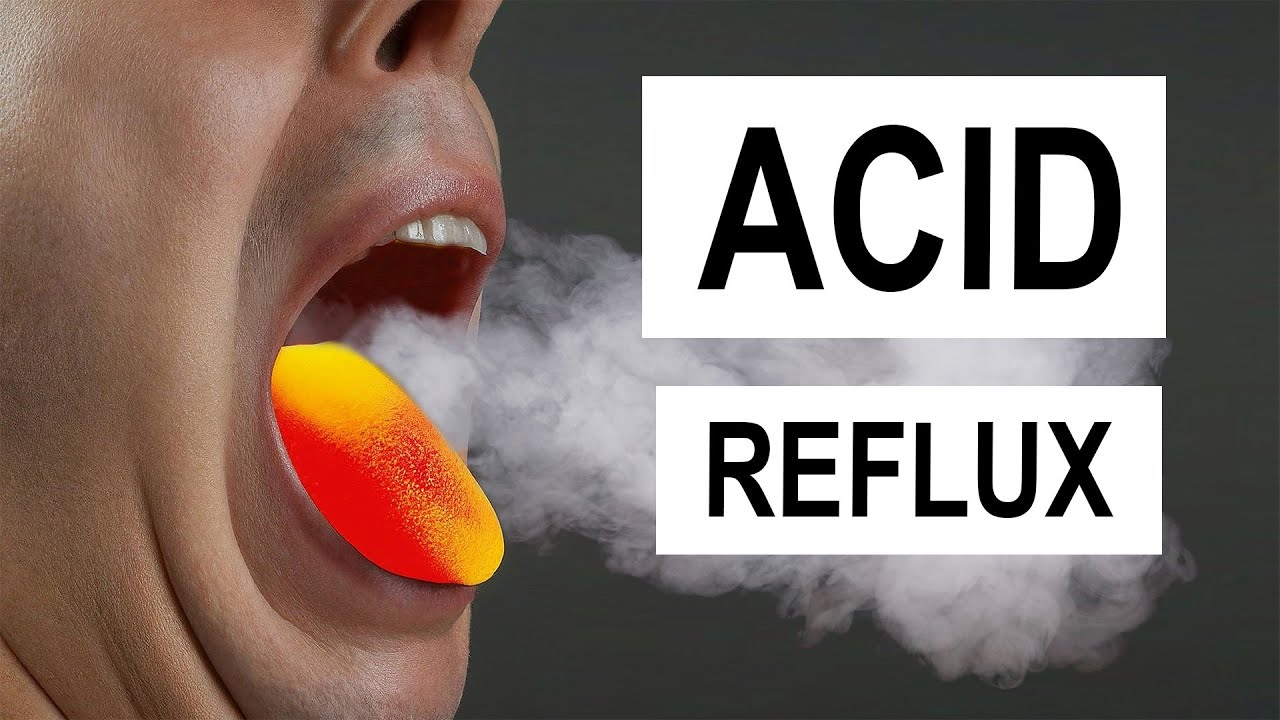 How Acid Reflux DESTROYS Your Throat