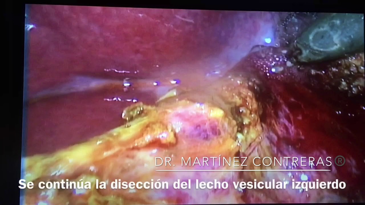 Arturo Martínez Contreras-10