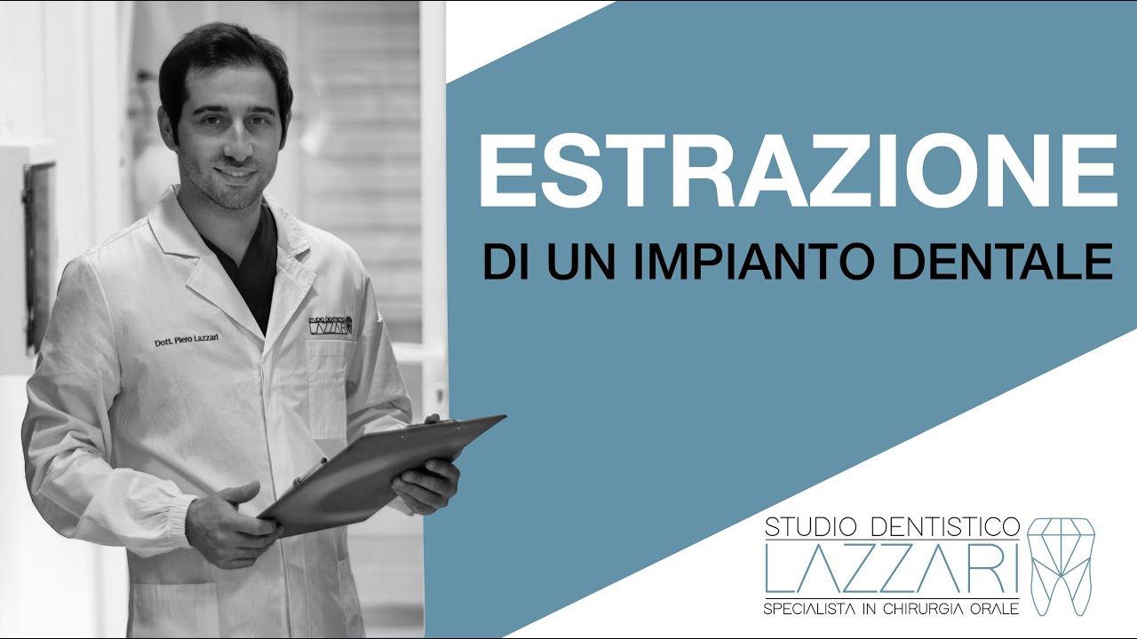 Quando si deve rimuovere un impianto dentale