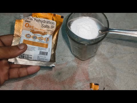 Prolyte ORS Honest Review