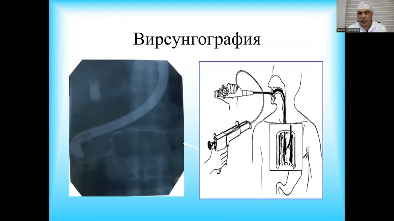 Meda osti bezi kasalliklari