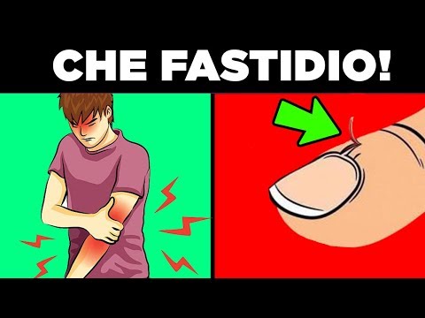 Fluido nel ginocchio pompaggio giunto Nastri Kinesis per il prezzo congiunta