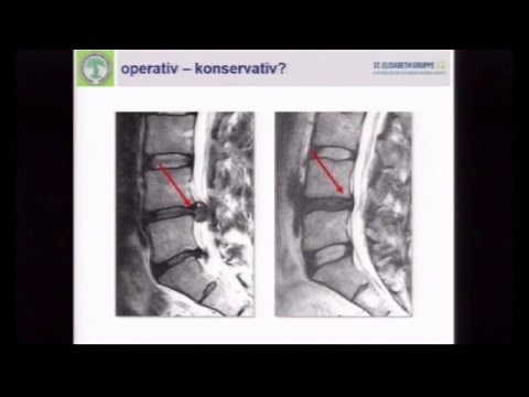 02/17 - Medical Taping bei Schmerzsyndromen der Wirbelsäule