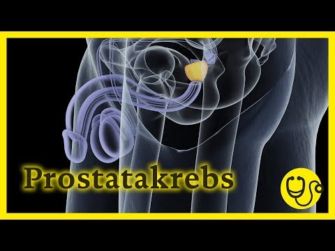 Dr. Nützlich - Prostatakrebs: Symptome & Behandlung mit da Vinci-Roboter, Kantonsspital Baselland