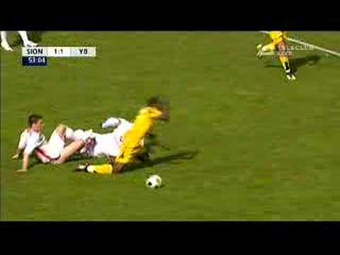 Entstehung eines Kreuzbandrisses