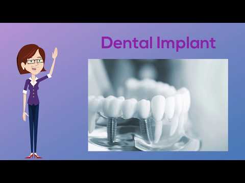 Dental Implant in Sydney