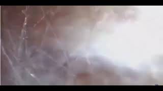 What is Connective Tissue and How Does It Work A Detailed Exploration #icoone #connectivetissue