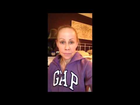 Laura’s Facelift Journey: Part 2