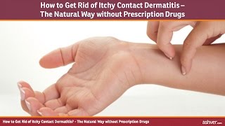 How to Get Rid of Itchy Contact Dermatitis - The Natural Way without Prescription Drugs
