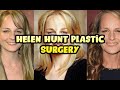 Helen Hunt Plastic Surgery
