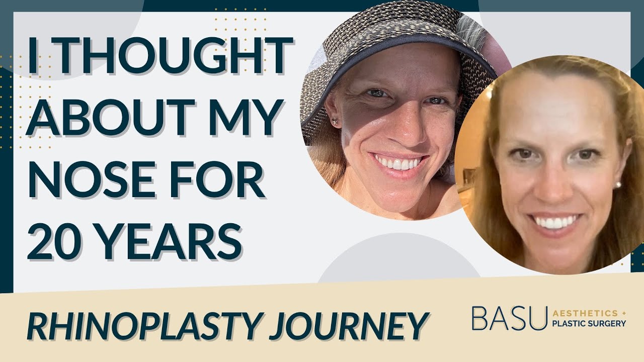 I Thought About My Nose for 20 Years - Andrea’s Rhinoplasty