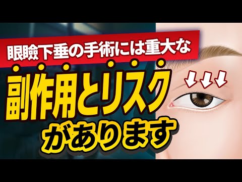 医学科 やる前に知っておくべき！眼瞼下垂の手術には副作用とリスクがあります